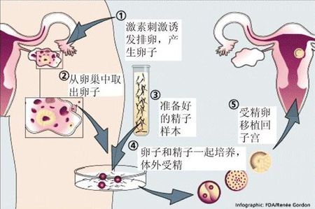 医疗设备